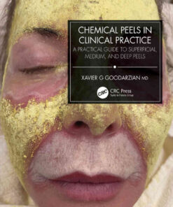Chemical Peels in Clinical Practice: A Practical Guide to Superficial, Medium, and Deep Peels eBook