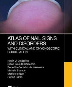 Atlas of Nail Signs and Disorders with Clinical and Onychoscopic Correlation eBook