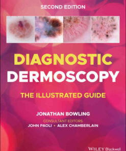 Diagnostic Dermoscopy: The Illustrated Guide eBook
