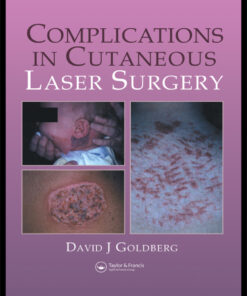 Complications in Laser Cutaneous Surgery eBook
