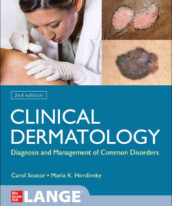 Clinical Dermatology: Diagnosis and Management of Common Disorders eBook