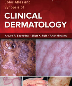 Fitzpatrick's Color Atlas and Synopsis of Clinical Dermatology eBook