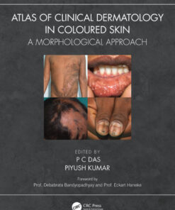 Atlas of Clinical Dermatology in Coloured Skin: A Morphological Approach eBook