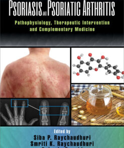 Psoriasis and Psoriatic Arthritis: Pathophysiology, Therapeutic Intervention, and Complementary Medicine eBook