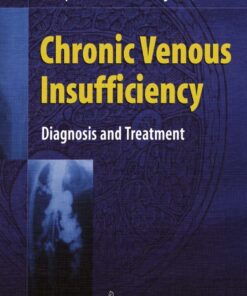 Chronic Venous Insufficiency: Diagnosis and Treatment eBook