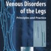 Venous Disorders of the Legs: Principles and Practice eBook