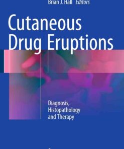 Cutaneous Drug Eruptions: Diagnosis, Histopathology and Therapy eBook