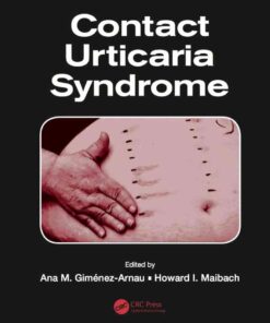Contact Urticaria Syndrome eBook
