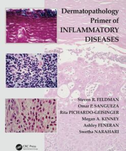 Dermatopathology Primer of Inflammatory Diseases eBook