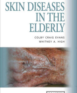 Skin Diseases in the Elderly: A Color Handbook eBook