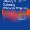 Pathology of Challenging Melanocytic Neoplasms: Diagnosis and Management eBook
