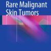 Rare Malignant Skin Tumors eBook