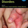 Pediatric Nail Disorders eBook