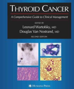 Thyroid Cancer: A Comprehensive Guide to Clinical Management eBook