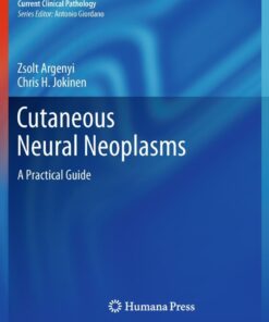 Cutaneous Neural Neoplasms: A Practical Guide eBook