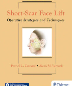 Short-Scar Face Lift: Operative Strategies and Techniques eBook
