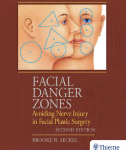 Facial Danger Zones: Avoiding Nerve Injury in Facial Plastic Surgery eBook