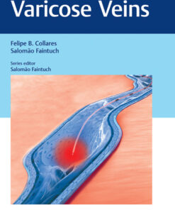 Varicose Veins: Practical Guides in Interventional Radiology eBook