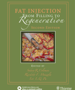 Fat Injection: From Filling to Regeneration eBook