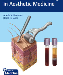 PRP and Microneedling in Aesthetic Medicine eBook