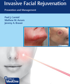Complications in Minimally Invasive Facial Rejuvenation: Prevention and Management eBook