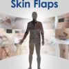 Making Decisions and Avoiding Complications in Skin Flaps eBook
