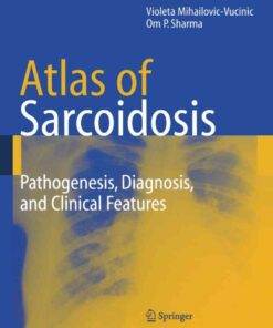 Atlas of Sarcoidosis: Pathogenesis, Diagnosis and Clinical Features eBook