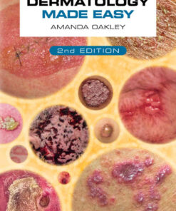 Dermatology Made Easy eBook