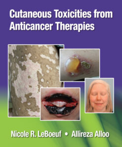 Cutaneous Reactions from Anti-Cancer Therapies eBook