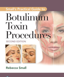Small's Practical Guide to Botulinum Toxin Procedures eBook