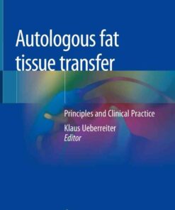 Autologous fat tissue transfer: Principles and Clinical Practice eBook