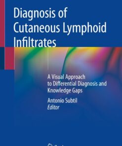 Diagnosis of Cutaneous Lymphoid Infiltrates: A Visual Approach to Differential Diagnosis and Knowledge Gaps eBook