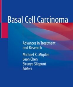 Basal Cell Carcinoma: Advances in Treatment and Research eBook