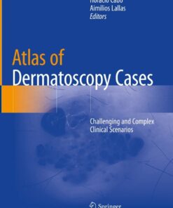 Atlas of Dermatoscopy Cases: Challenging and Complex Clinical Scenarios eBook
