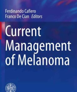 Current Management of Melanoma eBook