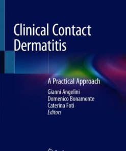 Clinical Contact Dermatitis: A Practical Approach eBook
