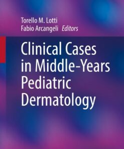 Clinical Cases in Middle-Years Pediatric Dermatology eBook