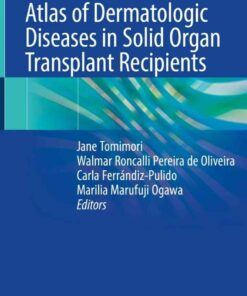 Atlas of Dermatologic Diseases in Solid Organ Transplant Recipients eBook