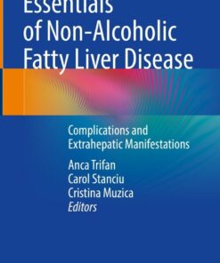Essentials of Non-Alcoholic Fatty Liver Disease: Complications and Extrahepatic Manifestations eBook
