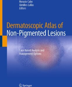 Dermatoscopic Atlas of Non-Pigmented Lesions: Case-based Analysis and Management Options eBook
