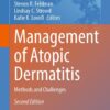 Management of Atopic Dermatitis: Methods and Challenges eBook