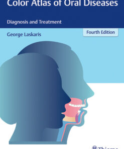 Color Atlas of Oral Diseases: Diagnosis and Treatment eBook