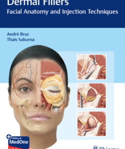 Dermal Fillers: Facial Anatomy and Injection Techniques eBook