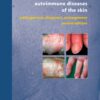 Autoimmune Diseases of the Skin: Pathogenesis, Diagnosis, Management eBook