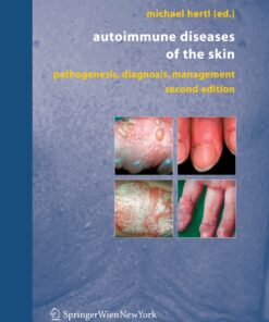 Autoimmune Diseases of the Skin: Pathogenesis, Diagnosis, Management eBook