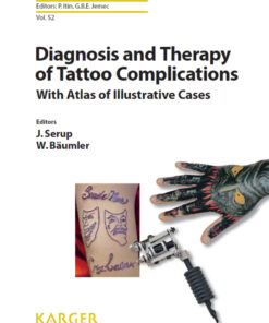 Diagnosis and Therapy of Tattoo Complications: With Atlas of Illustrative Cases eBook