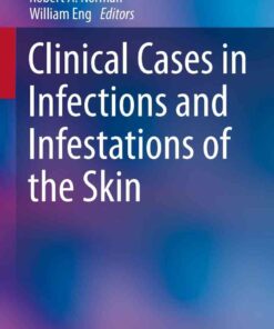 Clinical Cases in Infections and Infestations of the Skin eBook