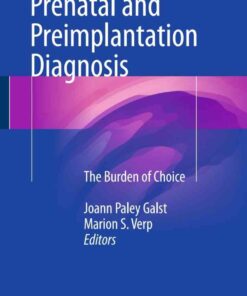 Prenatal and Preimplantation Diagnosis: The Burden of Choice eBook