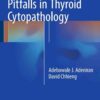 Common Diagnostic Pitfalls in Thyroid Cytopathology eBook