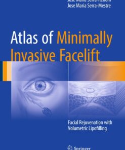 Atlas of Minimally Invasive Facelift: Facial Rejuvenation with Volumetric Lipofilling eBook